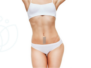 Depilacion Laser Media Linea de Abdomen